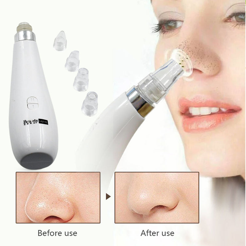 0351A Blackhead Remover Vacuum Suction Facial Pore Cleaner Dermabrasion Face Facial Pore Cleaner, Beauty Device kit with 4 Suction Probes for Women & Men